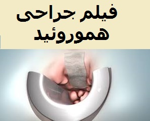 فیلم عمل جراحی هموروئید