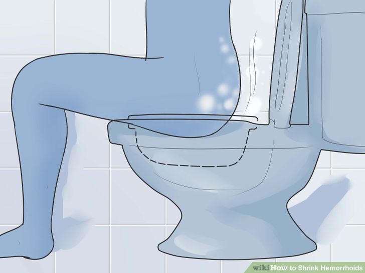نشستن در لگن آب گرم روی توالت فرنگی