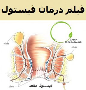 برای دیدن این فیلم بر روی تصوی کلیک کنید