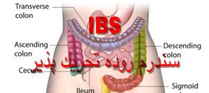 سندرم روده تحریک پذیر IBS