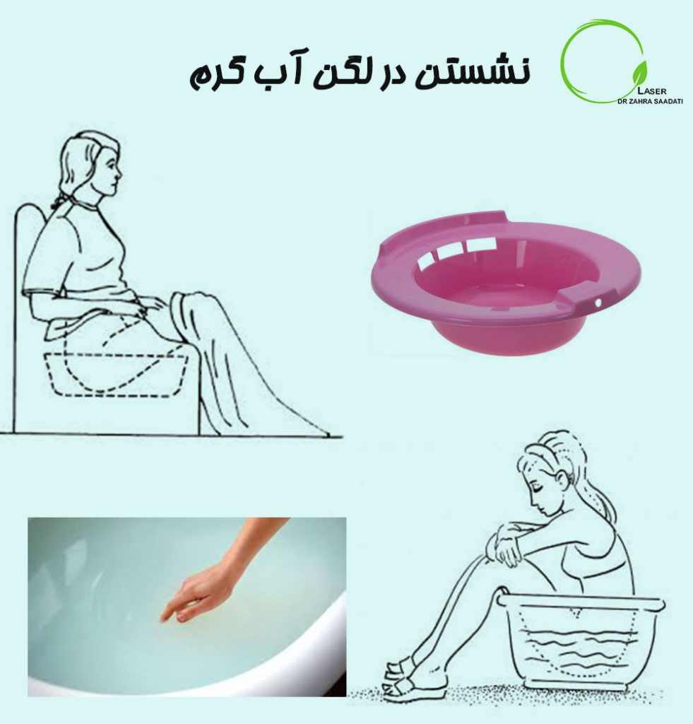 همه چیز درباره بیماری همورویید دکتر زهرا سعادتی متخصص جراحی و لیزر