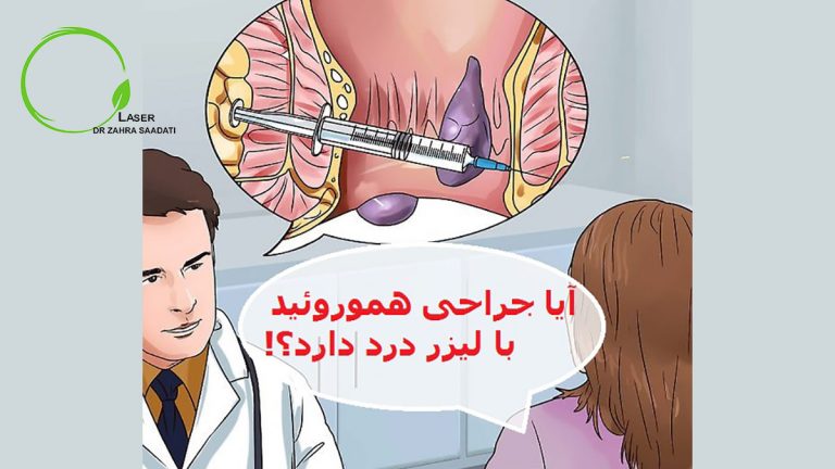 آیا عمل جراحی هموروئید با لیزر درد دارد