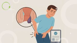 هموروئید در مردان یا بواسیر و باباسیل در آقایان علت و درمان و عمل