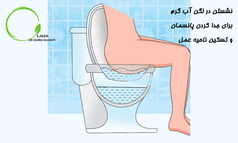 دوره نقاهت بعد از عمل شقاق دکتر زهرا سعادتی متخصص جراحی و لیزر