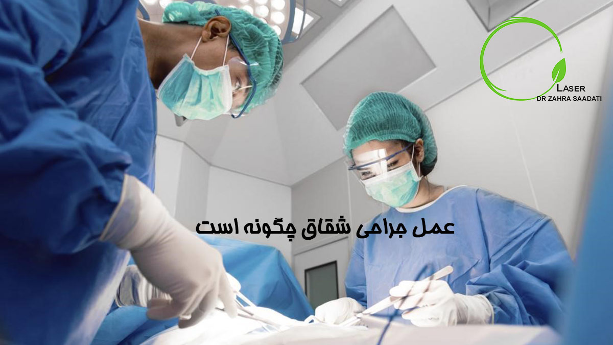 عمل جراحی شقاق چگونه است