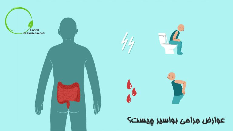 عوارض جراحی بواسیر چیست