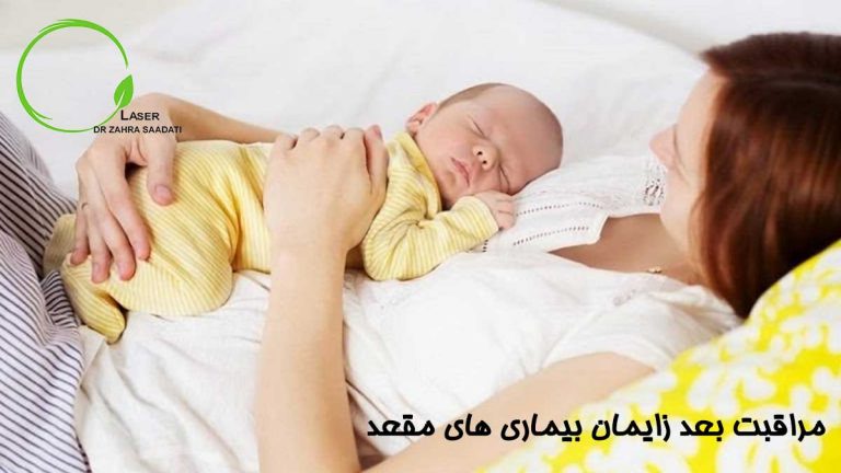 مراقبت بعد زایمان بیماری های مقعد