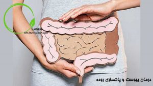 درمان یبوست و پاکسازی روده