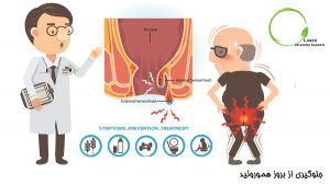 جلوگیری از هموروئید