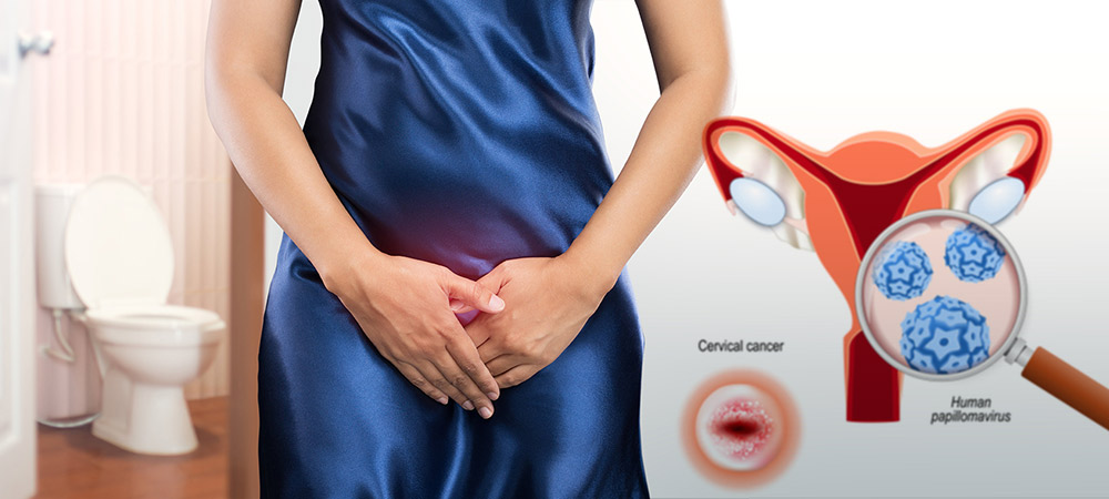 genital warts diagnosis