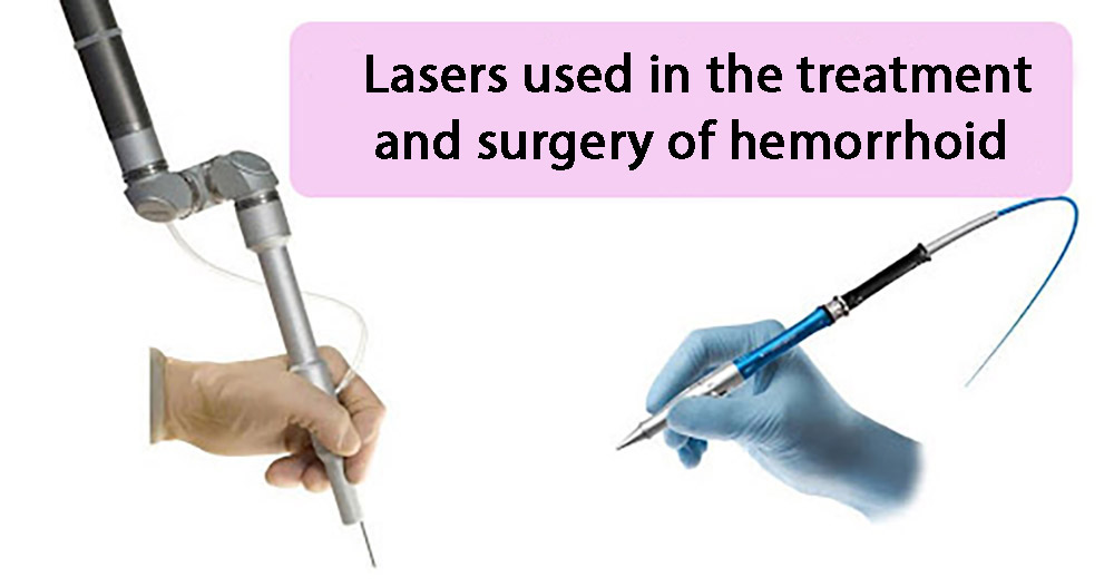 Surgical laser handles for hemorrhoid laser treatment