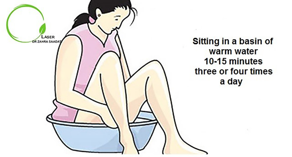 A woman who relieves hemorrhoid pain by sitting in a basin of warm water