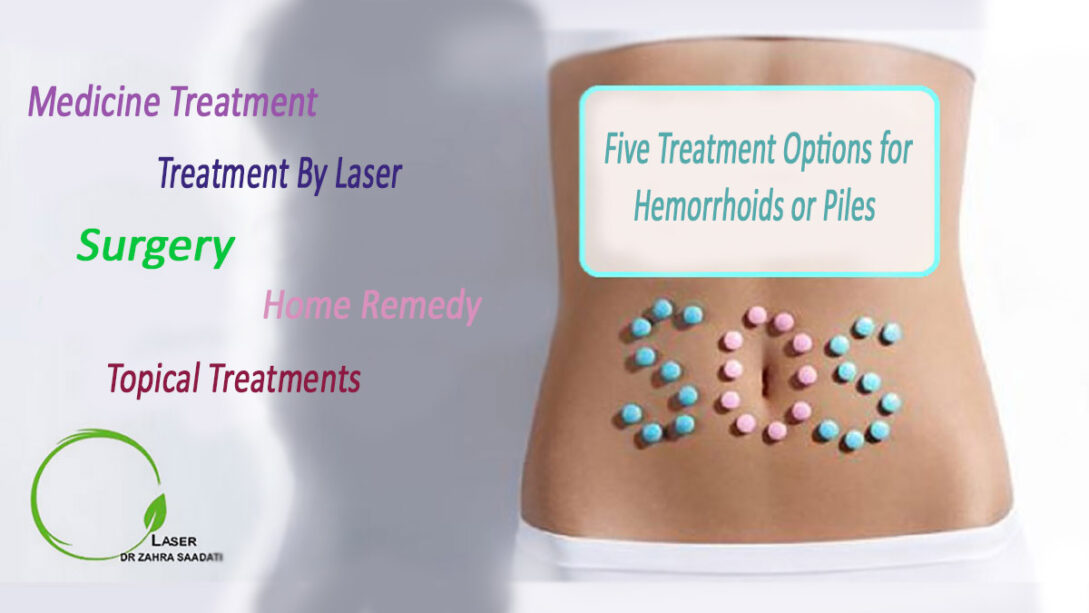 Five Treatment Options For Hemorrhoids Or Piles Dr Zahra Saadati Laser Surgery 2978