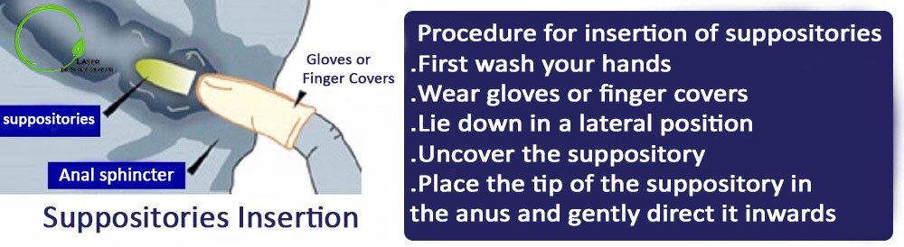 Procedure for insertion of suppositories 