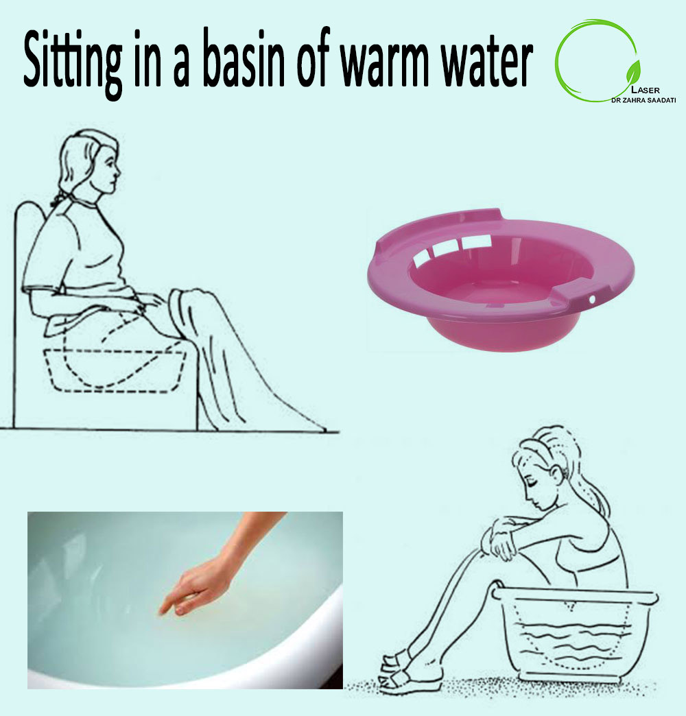 how to use sitz bath and sitting in a basin of warm water