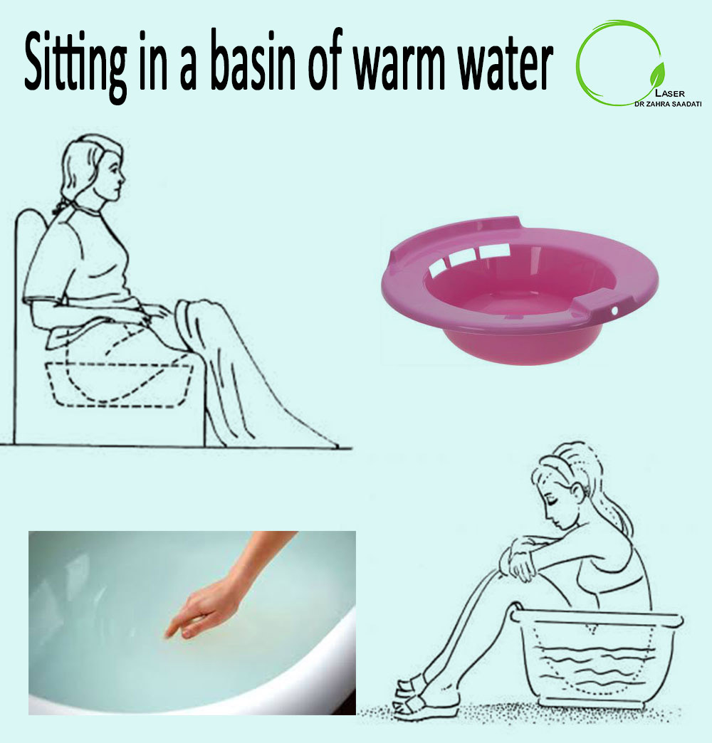 sitz-bath-purpose-benefits-instructions