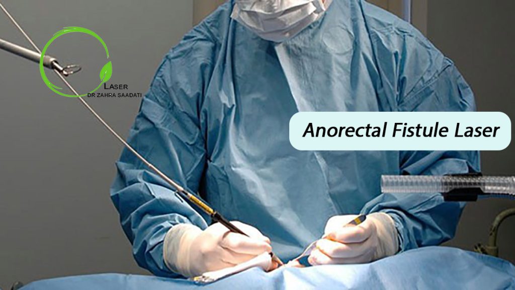Anal Fistule Laser Dr Zahra Saadati Laser Surgery