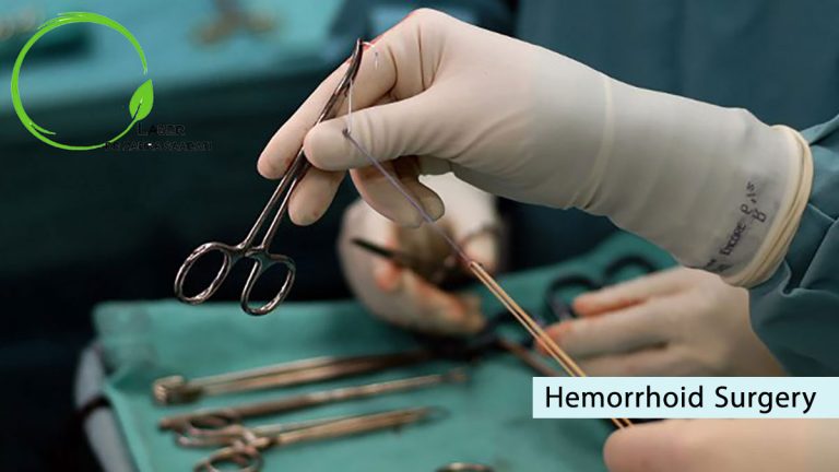 hemorrhoid surgery