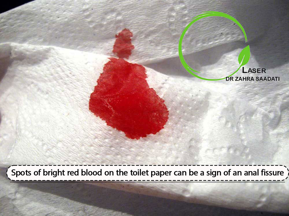 light blood on tissue paper