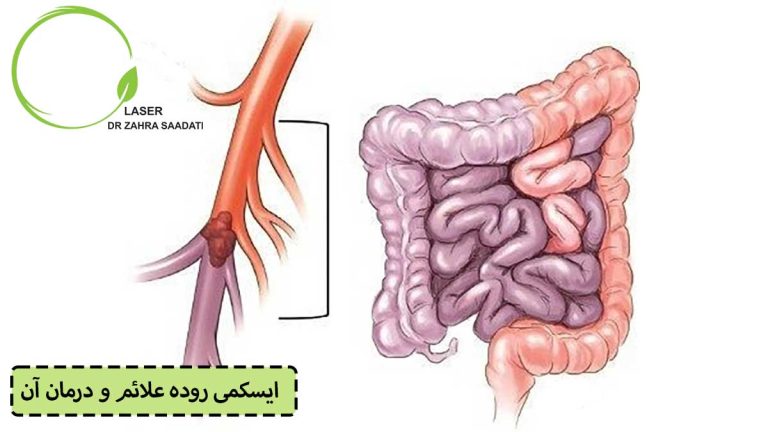 ایسکمی روده علائم و درمان آن