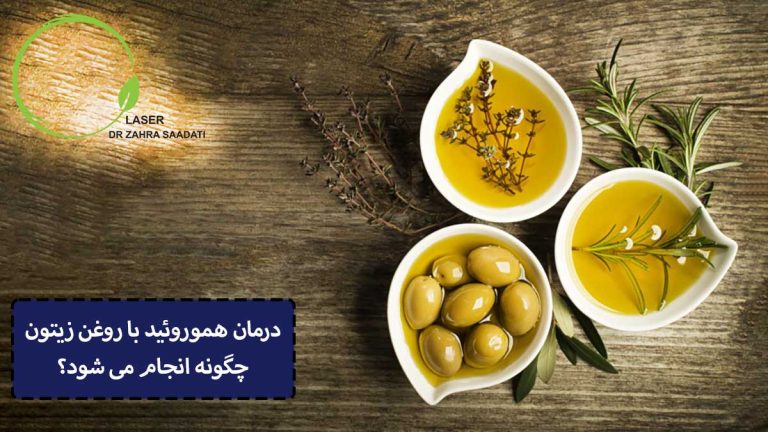 درمان هموروئید با روغن زیتون چگونه انجام می شود