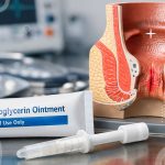 استفاده از پماد نیتروگلیسیرین برای درمان شقاق مقعدی